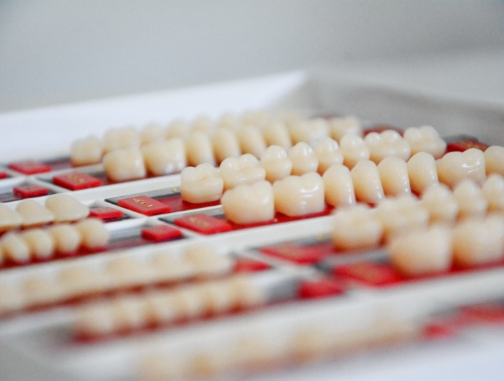 veneers